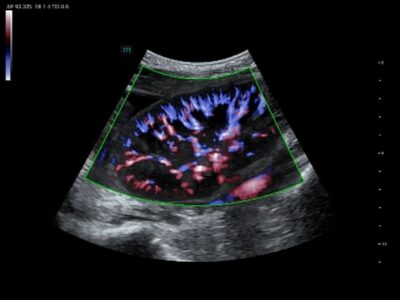 Screenshot 2025-02-14 at 15-05-53 Resona A20 - Premium Ultrasound System for Radiology - Mindray