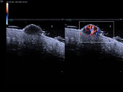 Screenshot 2025-02-14 at 15-06-01 Resona A20 - Premium Ultrasound System for Radiology - Mindray