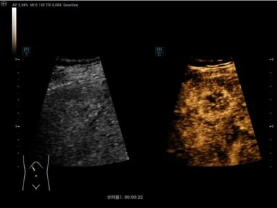 Screenshot 2025-02-14 at 15-07-56 Resona A20 - Premium Ultrasound System for Radiology - Mindray